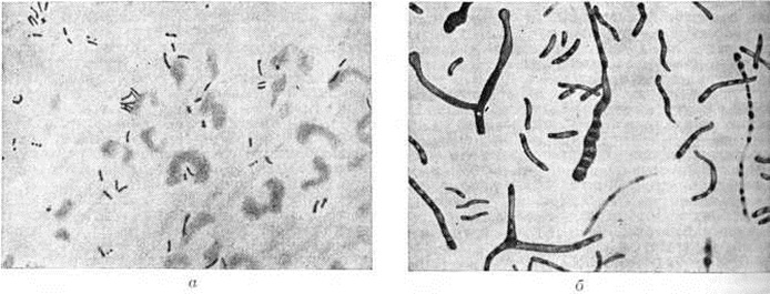 Палочки в мокроте. Mycobacterium tuberculosis в мокроте под микроскопом. Микроскопия мокроты на туберкулез. Микобактерии туберкулеза в мокроте. Палочка Коха под микроскопом.